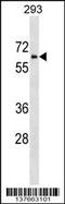 Zinc Finger HIT-Type Containing 6 antibody, 59-330, ProSci, Western Blot image 
