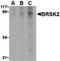 BR Serine/Threonine Kinase 2 antibody, LS-C19697, Lifespan Biosciences, Western Blot image 