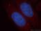 Alcohol Dehydrogenase 1C (Class I), Gamma Polypeptide antibody, 18897-1-AP, Proteintech Group, Immunofluorescence image 