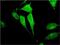 Tripartite Motif Containing 17 antibody, MA5-21862, Invitrogen Antibodies, Immunofluorescence image 