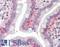 TPC antibody, LS-B9893, Lifespan Biosciences, Immunohistochemistry paraffin image 