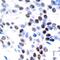 Jun Proto-Oncogene, AP-1 Transcription Factor Subunit antibody, 79-271, ProSci, Immunohistochemistry paraffin image 