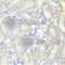 PSTPIP1 antibody, A7760, ABclonal Technology, Immunohistochemistry paraffin image 