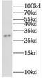 Stomatin-like protein 3 antibody, FNab08348, FineTest, Western Blot image 