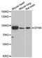 Glycerol-3-Phosphate Acyltransferase, Mitochondrial antibody, orb247523, Biorbyt, Western Blot image 