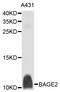 BAGE Family Member 2 antibody, abx136069, Abbexa, Western Blot image 