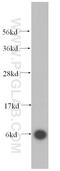 Ribosomal Protein L39 antibody, 14990-1-AP, Proteintech Group, Western Blot image 