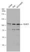 Zinc phosphodiesterase ELAC protein 2 antibody, GTX130499, GeneTex, Western Blot image 