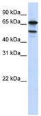 SURP And G-Patch Domain Containing 1 antibody, TA344018, Origene, Western Blot image 