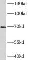 CgA antibody, FNab01687, FineTest, Western Blot image 