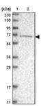 Ankyrin Repeat Domain 44 antibody, PA5-56352, Invitrogen Antibodies, Western Blot image 