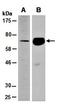 Netrin G2 antibody, orb67221, Biorbyt, Western Blot image 