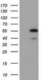 Epoxide Hydrolase 2 antibody, TA501599, Origene, Western Blot image 