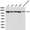Histone Deacetylase 4 antibody, LS-C192669, Lifespan Biosciences, Western Blot image 