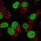 Origin Recognition Complex Subunit 2 antibody, NBP2-56503, Novus Biologicals, Immunofluorescence image 