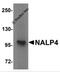 NLR Family Pyrin Domain Containing 4 antibody, 5957, ProSci, Western Blot image 