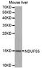 NADH:Ubiquinone Oxidoreductase Subunit S5 antibody, TA332396, Origene, Western Blot image 