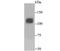 NPC Intracellular Cholesterol Transporter 1 antibody, A00428-1, Boster Biological Technology, Western Blot image 