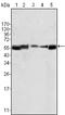 LYN Proto-Oncogene, Src Family Tyrosine Kinase antibody, STJ98226, St John
