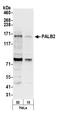 Partner And Localizer Of BRCA2 antibody, A301-247A, Bethyl Labs, Western Blot image 