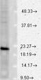 Vesicle-associated membrane protein 1 antibody, LS-C227434, Lifespan Biosciences, Western Blot image 