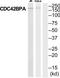 CDC42 Binding Protein Kinase Alpha antibody, TA313011, Origene, Western Blot image 