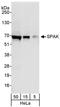 Serine/Threonine Kinase 39 antibody, A302-466A, Bethyl Labs, Western Blot image 