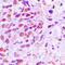 p65 antibody, LS-C352784, Lifespan Biosciences, Immunohistochemistry frozen image 