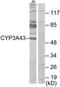 Cytochrome P450 Family 3 Subfamily A Member 43 antibody, TA315747, Origene, Western Blot image 