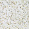 DEAD-Box Helicase 1 antibody, 22-324, ProSci, Immunohistochemistry paraffin image 