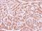 Fanconi anemia group E protein antibody, LS-C155307, Lifespan Biosciences, Immunohistochemistry paraffin image 