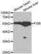Fibrinogen Beta Chain antibody, abx001220, Abbexa, Western Blot image 
