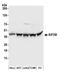 Eukaryotic translation initiation factor 3 subunit M antibody, A304-761A, Bethyl Labs, Western Blot image 