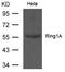 E3 ubiquitin-protein ligase RING1 antibody, orb225493, Biorbyt, Western Blot image 