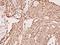 Cytochrome P450 Family 2 Subfamily C Member 19 antibody, A02102-1, Boster Biological Technology, Immunohistochemistry paraffin image 