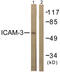 ICAM-5 antibody, OAAF00992, Aviva Systems Biology, Western Blot image 