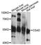 Cysteine Sulfinic Acid Decarboxylase antibody, LS-C748867, Lifespan Biosciences, Western Blot image 
