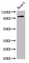 Protein Kinase D3 antibody, CSB-PA018713LA01HU, Cusabio, Western Blot image 