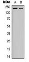 Kinase Insert Domain Receptor antibody, orb256644, Biorbyt, Western Blot image 