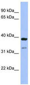 Ras Association Domain Family Member 7 antibody, TA335771, Origene, Western Blot image 