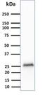 Ubiquitin C-Terminal Hydrolase L1 antibody, AE00125, Aeonian Biotech, Western Blot image 
