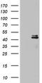 Ornithine Carbamoyltransferase antibody, CF802670, Origene, Western Blot image 