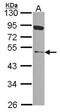 NIMA Related Kinase 2 antibody, NBP2-19510, Novus Biologicals, Western Blot image 