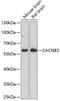 Calcium Voltage-Gated Channel Auxiliary Subunit Beta 3 antibody, 15-680, ProSci, Western Blot image 