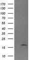 Cancer/Testis Antigen 1B antibody, TA505945BM, Origene, Western Blot image 
