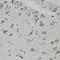 Vascular Endothelial Growth Factor C antibody, 18-707, ProSci, Immunohistochemistry frozen image 
