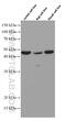 PP17 antibody, 66523-1-Ig, Proteintech Group, Western Blot image 