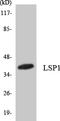 Lymphocyte Specific Protein 1 antibody, LS-C292149, Lifespan Biosciences, Western Blot image 