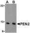 Presenilin Enhancer, Gamma-Secretase Subunit antibody, TA306368, Origene, Western Blot image 