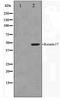 Keratin-17 antibody, TA347411, Origene, Western Blot image 